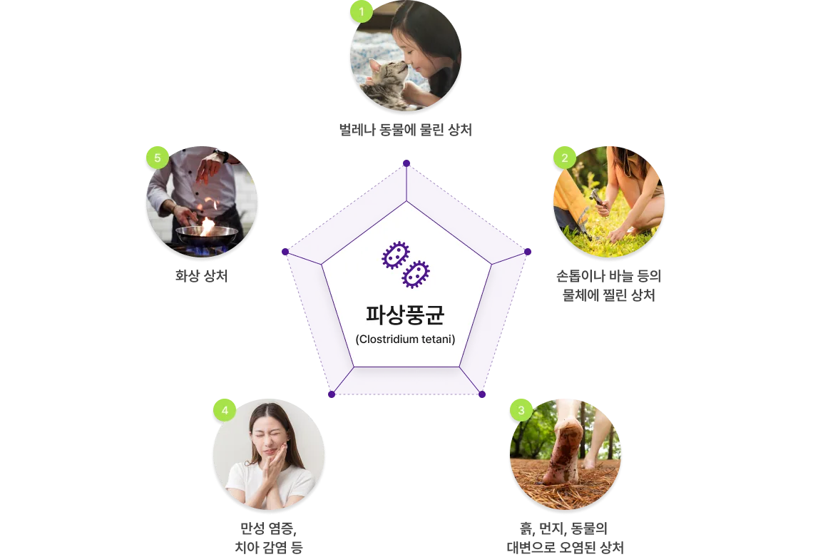 일상생활의 상처로 시작될 수 있는 파상풍